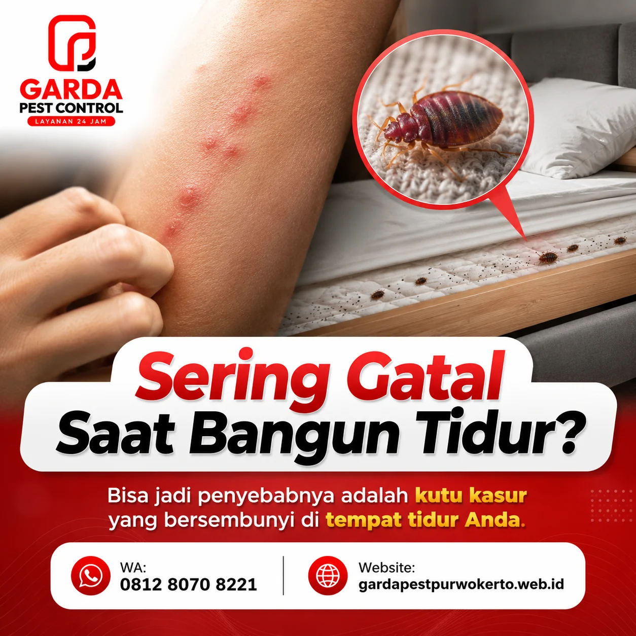 Jasa Pembasmi Kutu Kasur Untuk Hotel dan Penginapan Yang Cepat, Rapi, dan tepat sasaran